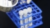 Teste PCR