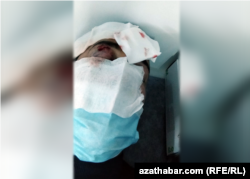 Turkmenistanski aktivista Aziz Mamadov posle ukazane medicinske pomoći, 11. oktobar 2021.