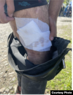 Raportul BVMN arată că migranții au fost bătuți de către serviciile de frontieră din România.