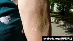 Сьляды зьбіцьця
