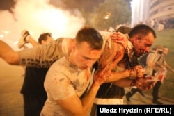 Rănit în timpul protestelor de la MInsk, 9 august 2020.