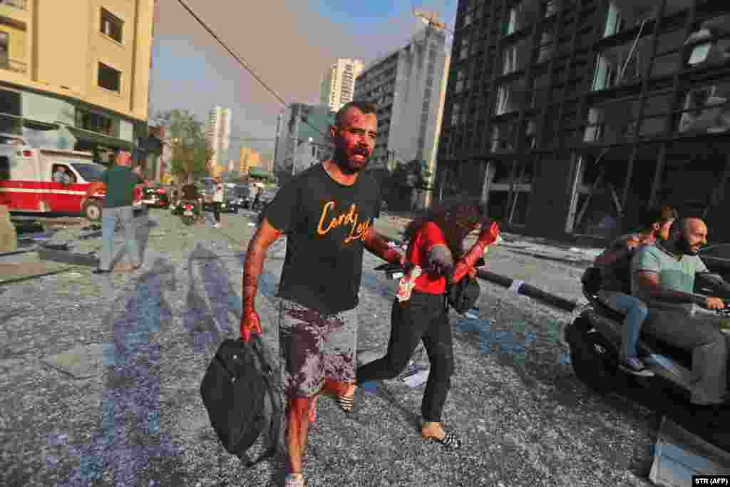 Njerëz të plagosur, duke u larguar nga zonat që u goditën nga shpërthimi masiv në Liban.&nbsp; &nbsp;