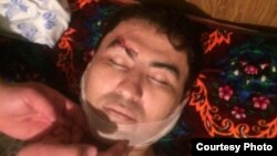 Родственники Муродиллы Омонова сомневаются в том, что он умер от сердечного приступа, так как после выдачи его тела они заметили, что правая бровь молодого предпринимателя была разбита в кровь. 