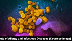 Coronavirus, surprins la microscopul electronic (în galben)